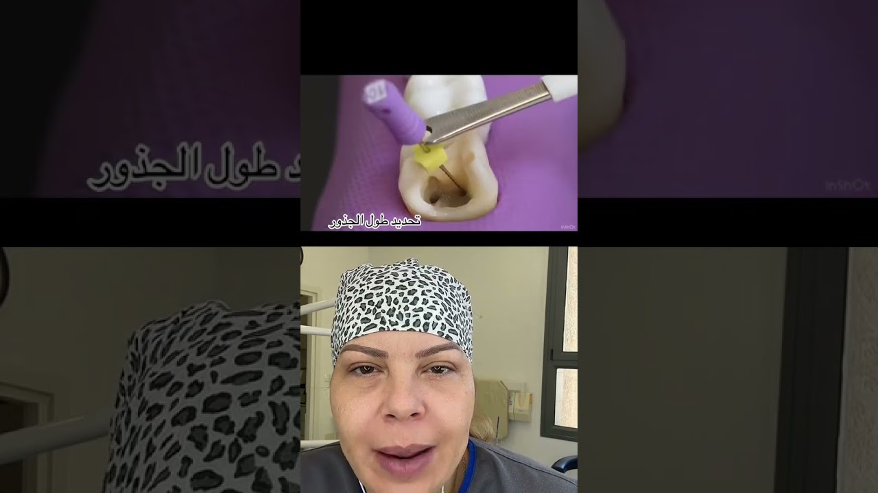 טיפול שורש: מה באמת קורה בתוך השן?