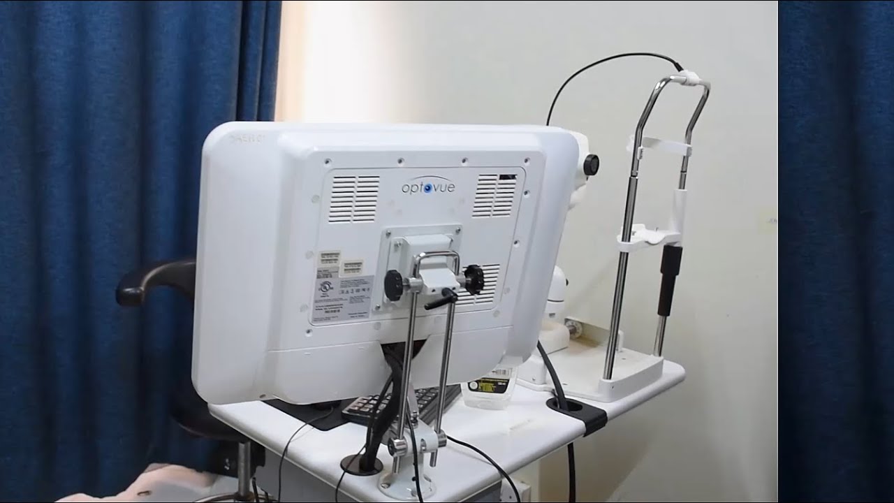 Optovue iVue II OCT: Advanced Eye Imaging Technology