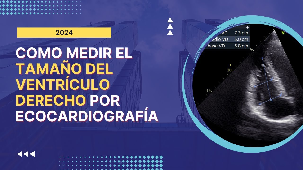🚀[Cómo Medir] el 🔥TAMAÑO DEL VENTRÍCULO DERECHO por Ecocardiografía: Guía Completa