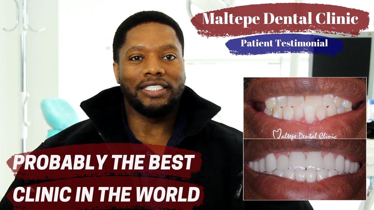 Dental Implant Experience in Turkey, Patient Review 2019 Istanbul | Maltepe Dental Clinic