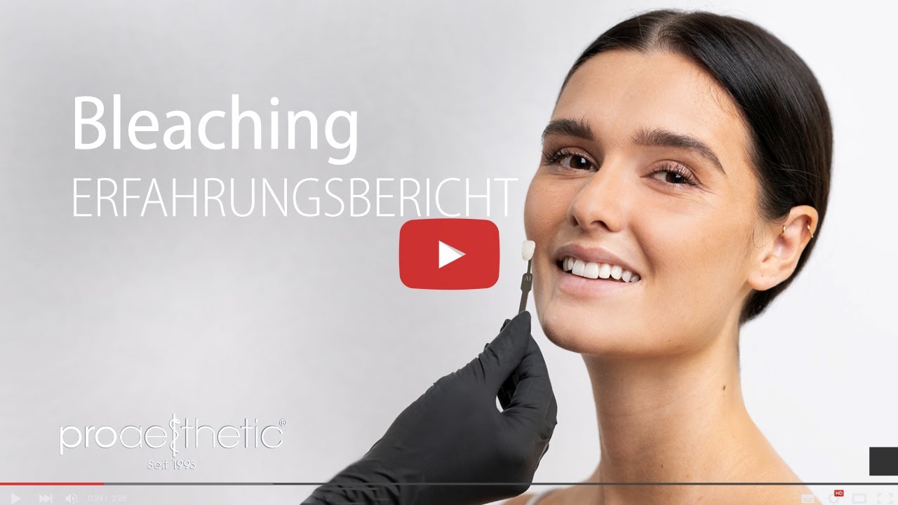 Bleaching | Erfahrungsbericht | proaesthetic Heidelberg
