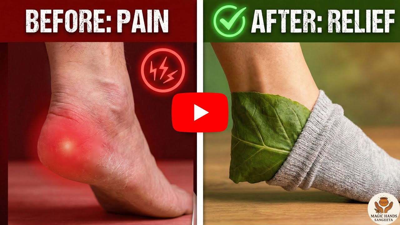 Edi Ka Dard Door Karne Ka Desi Nuskha 🌿 | Heel Pain Relief Gharelu Ilaj | Aak Ke Patte Ka Fayda