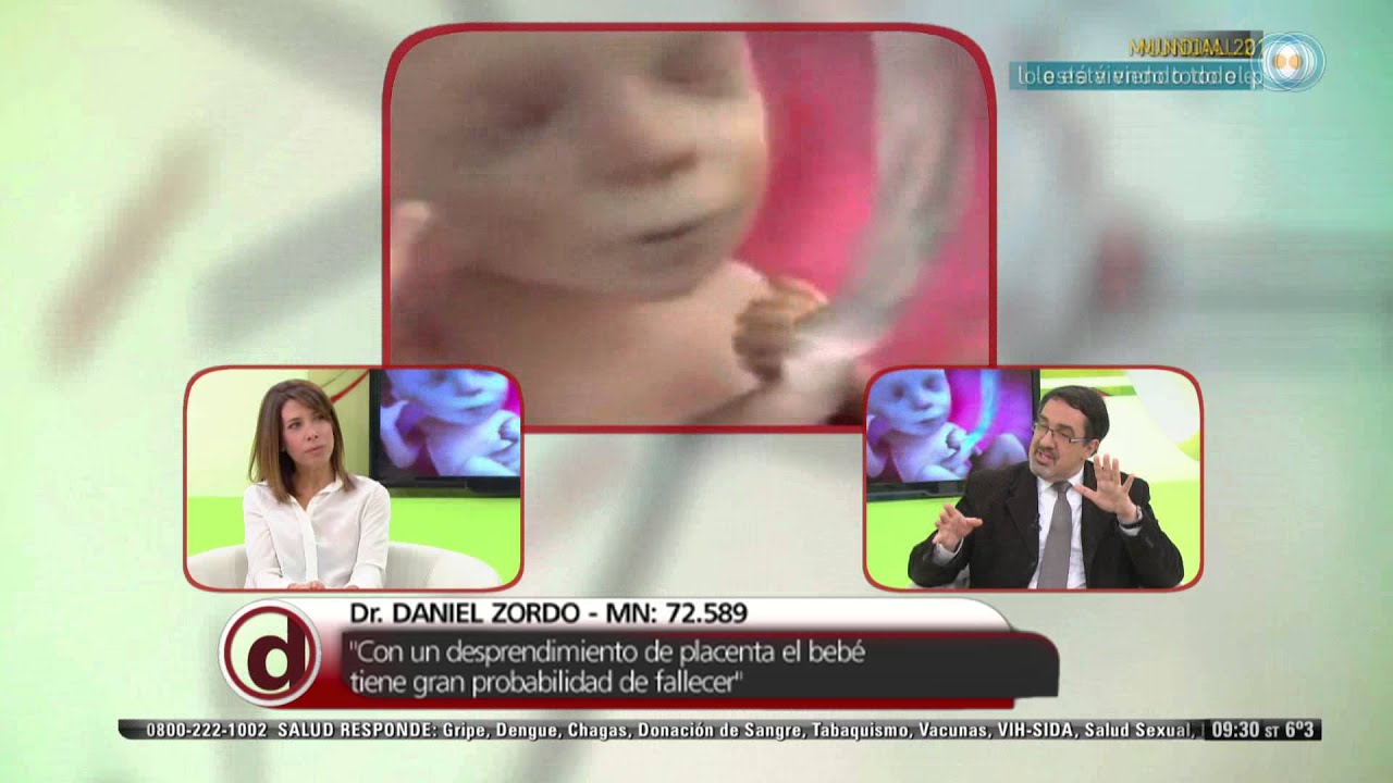 Red de Salud - Desprendimiento de placenta - 04-07-14
