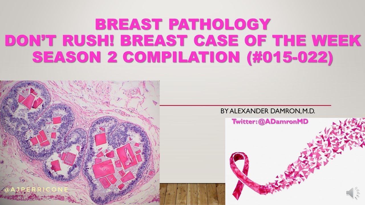 Don't Rush! Breast Case of the Week (Season 2 Compilation - Case #015-022)