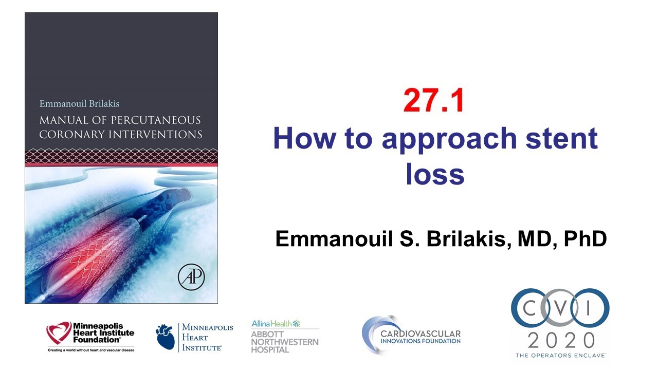 27.1 Stent loss - Manual of PCI