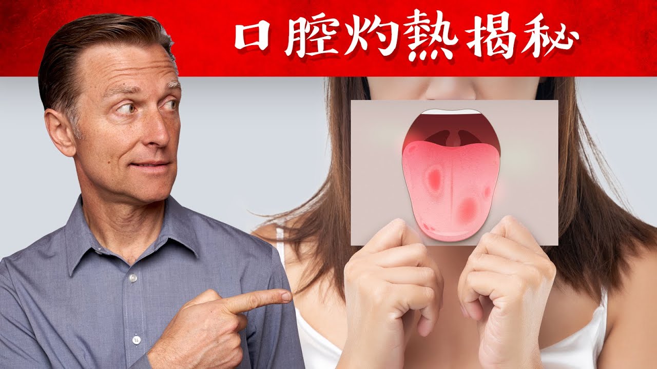 灼口症(口腔灼熱)揭秘, 缺五種營養素,自然療法,柏格醫生 Dr Berg