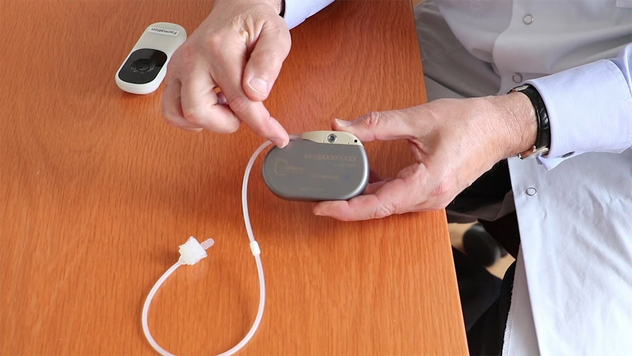 UroActive : le sphincter urinaire artificiel sans effort
