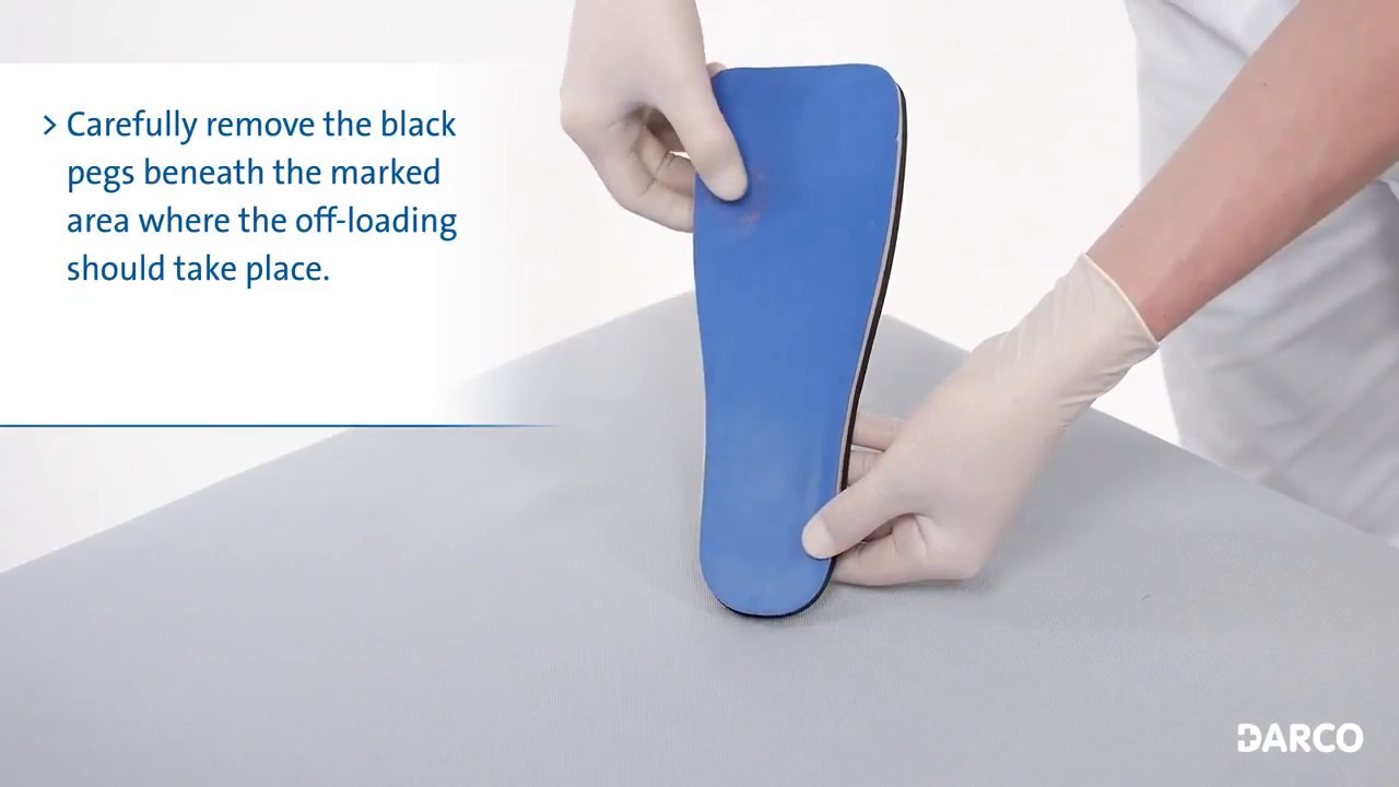 How to Use PegAssist® Insole Off loading Insoles