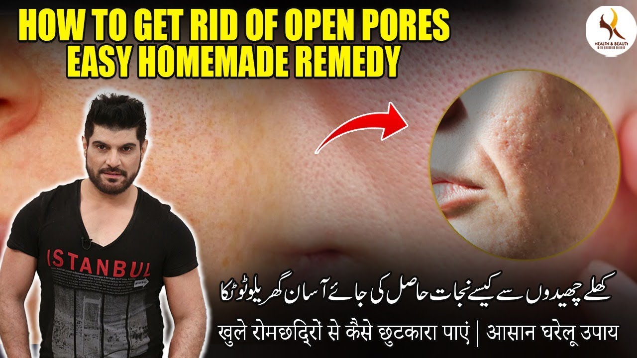 How to get rid of open pores | Easy homemade remedy by Dr. Khurram Mushir