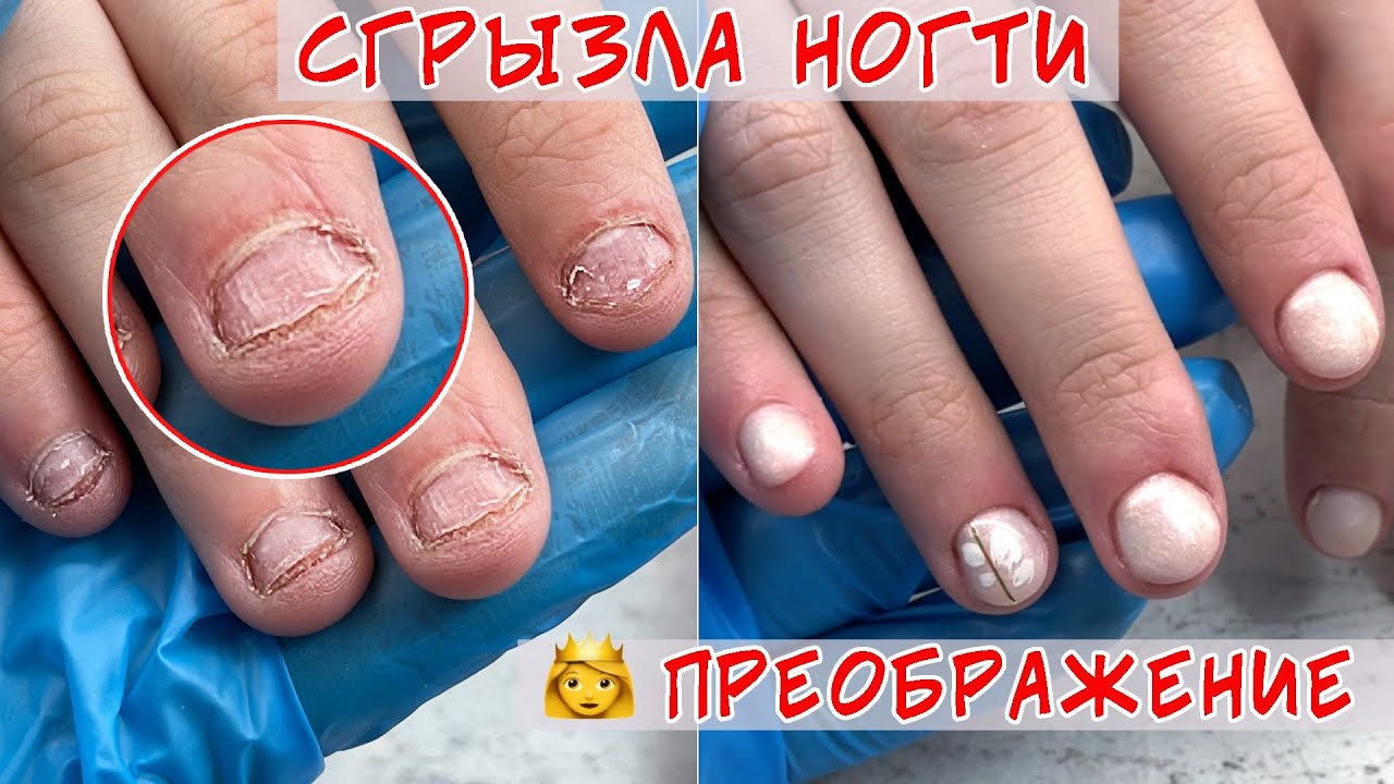 Обкусанные ногти наращивание / Грызуны