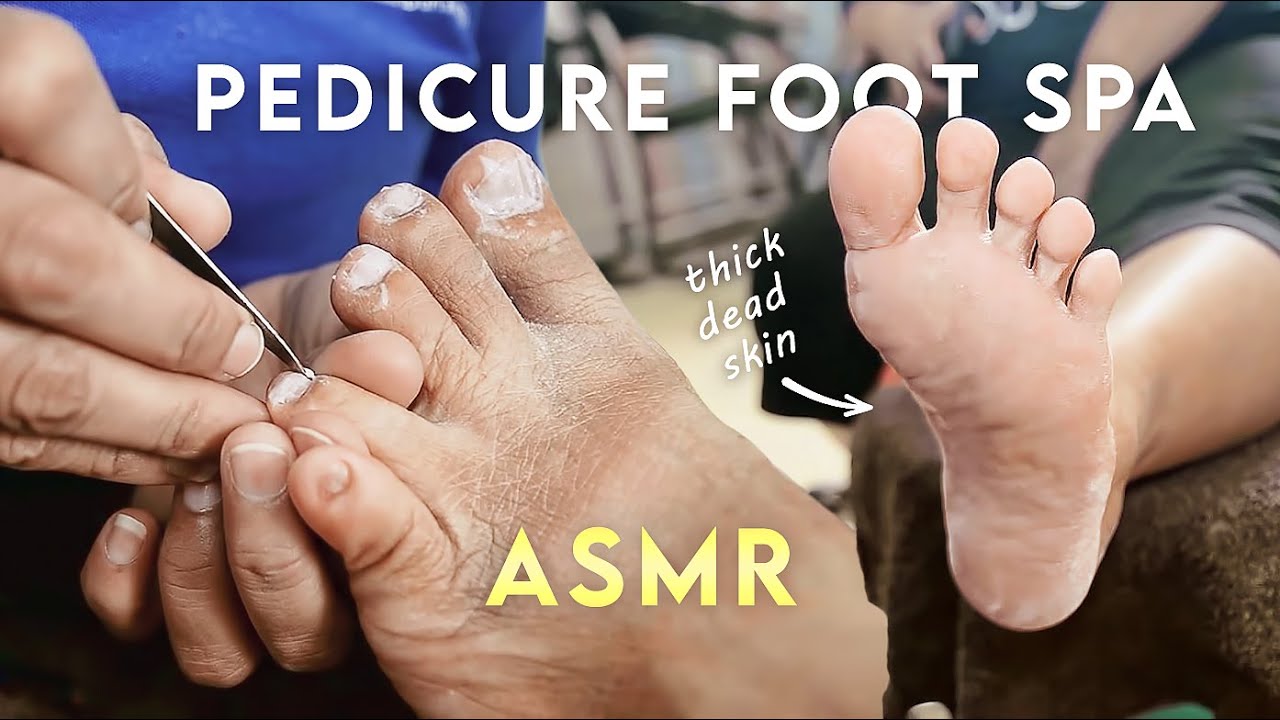 ASMR Pedicure | Removing Thick Dry Skin on Feet with Intensive Foot Spa