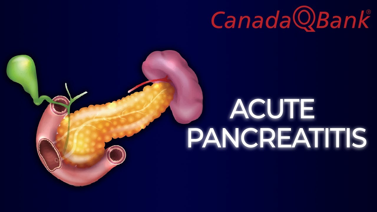 Acute Pancreatitis