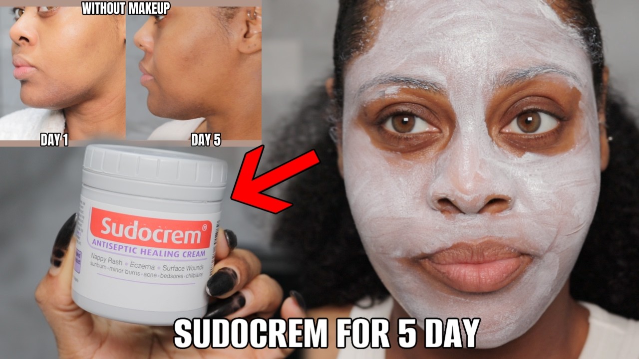 I TRIED SUDOCREM FOR 5 DAYS FOR SKIN TEXTURE! Crazy Results