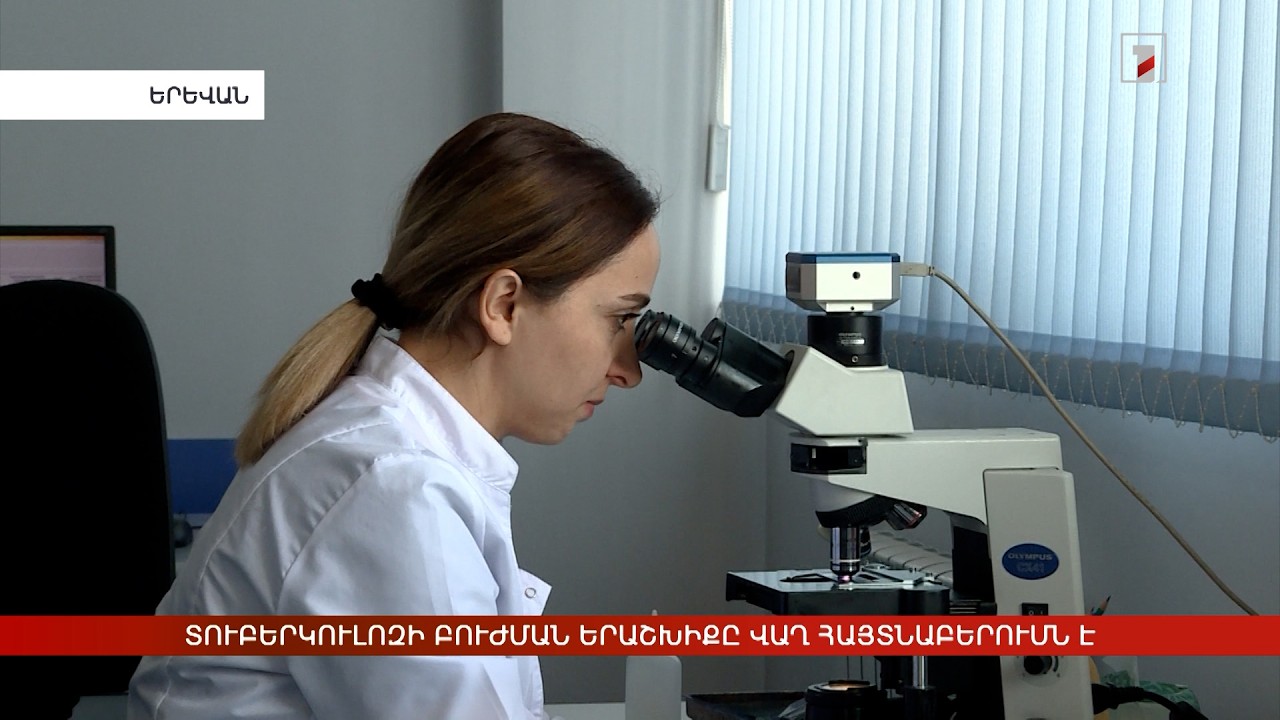 Տուբերկուլոզը բուժվող հիվանդություն է, եթե հայտնաբերվում է ժամանակին