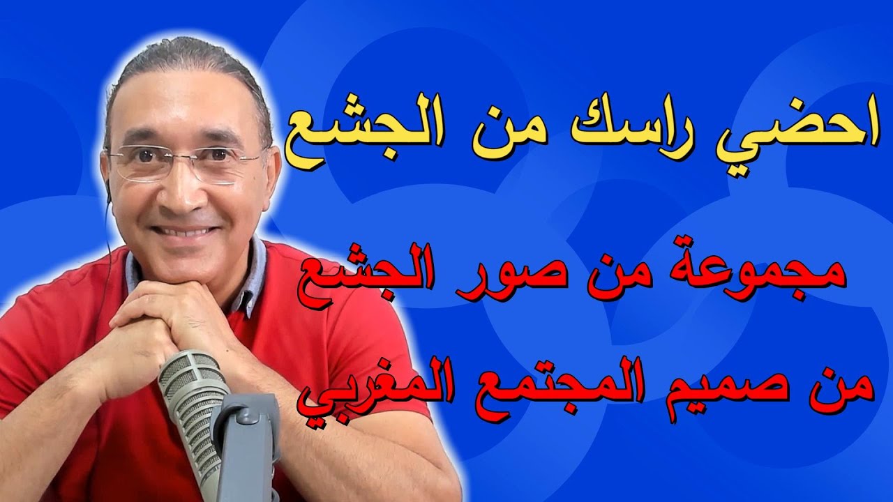 احضي راسك من الجشع الحلقة كاملة