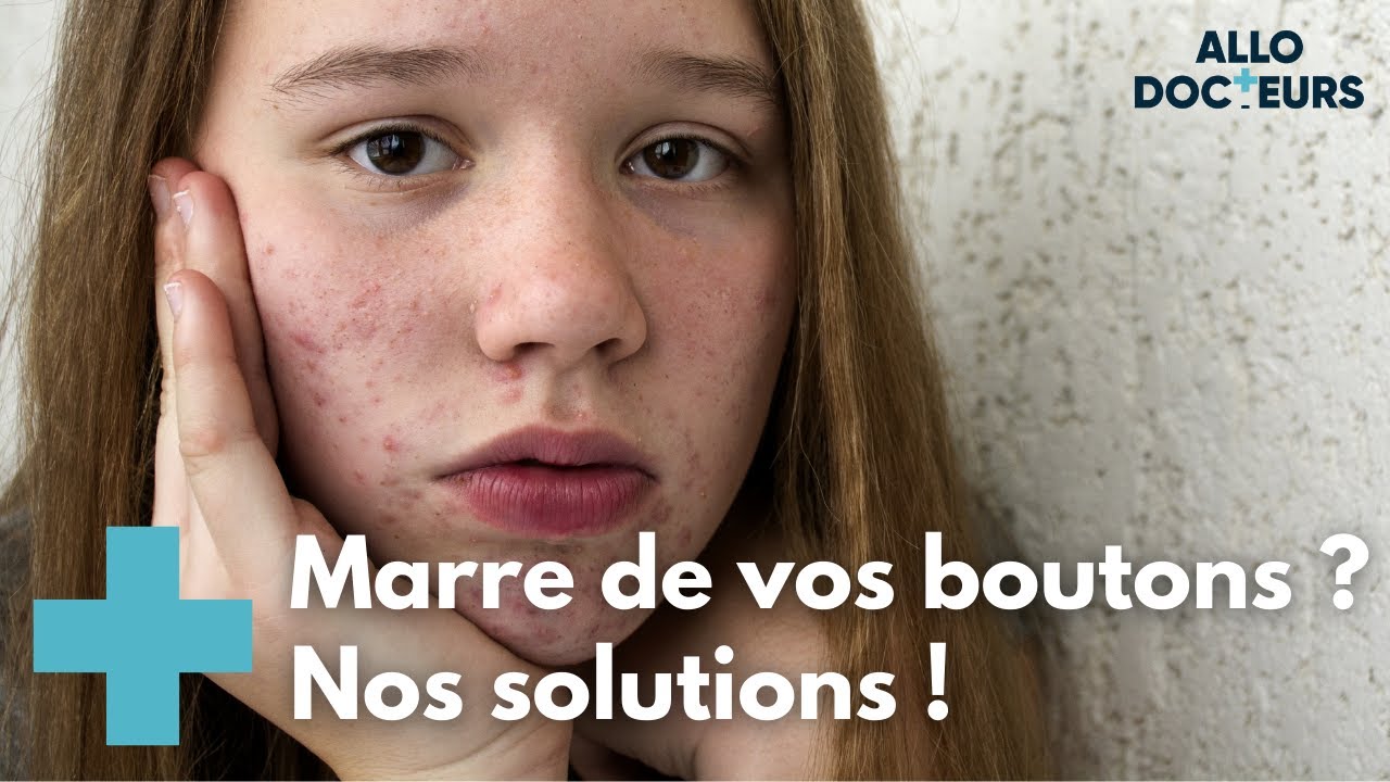 Toutes les réponses sur l'acné - AlloDocteurs