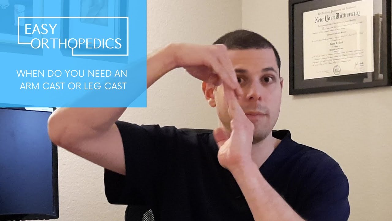 When do you need an arm cast or leg cast?
