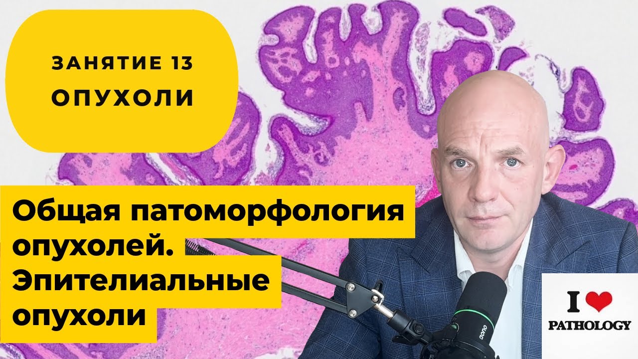 Обзор патоморфологии опухолей. Эпителиальные опухоли - краткий обзор занятия №13