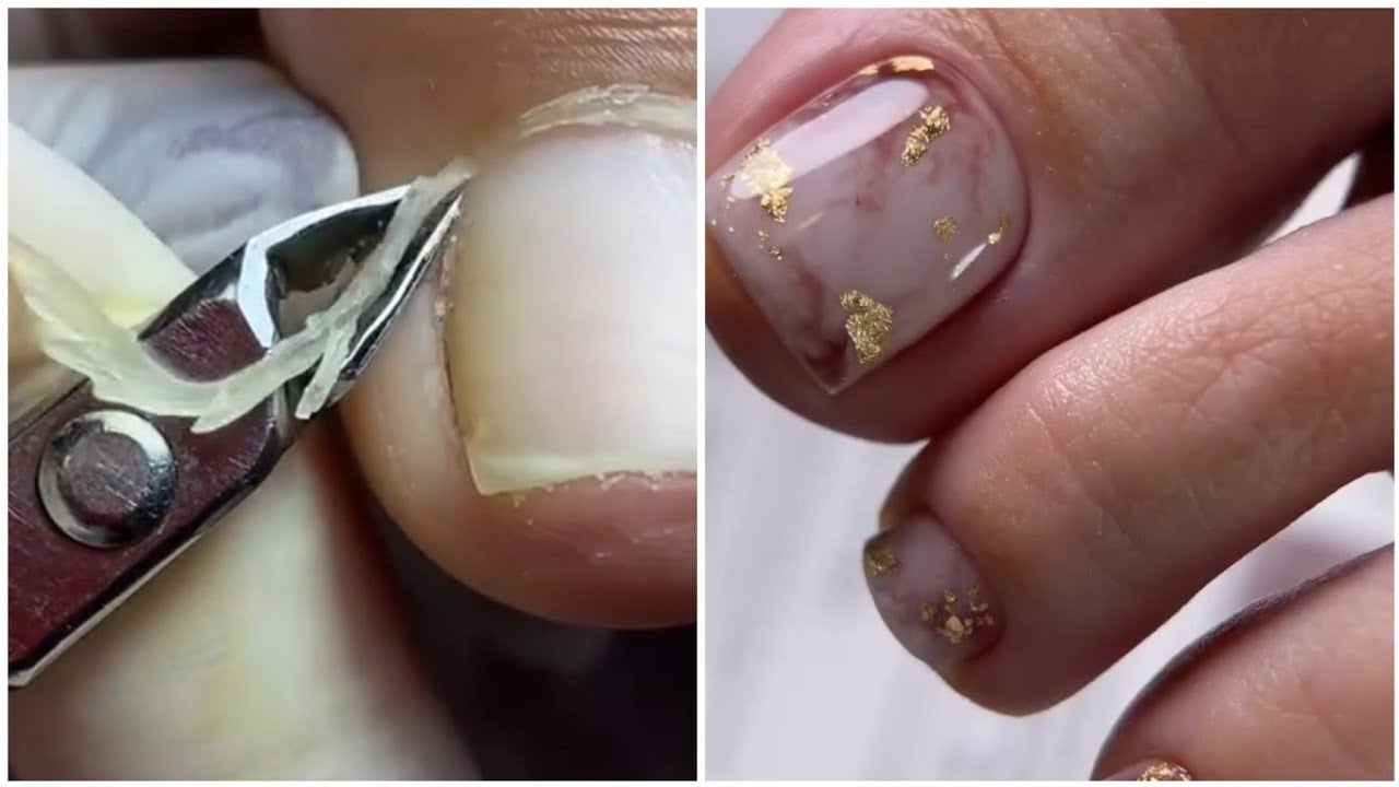 Most Satisfying Pedicure Transformation 2025