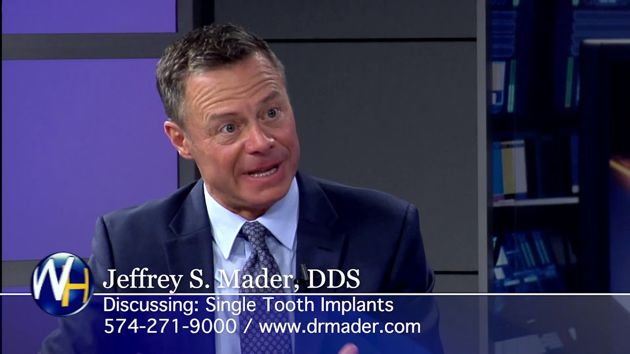 Single Tooth Implants with South Bend, IN dentist  Dr. Jeffrey Mader