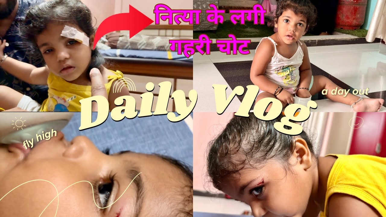 नित्या के लगी चोट #twins #twin #twinsisters #cutebaby #cute #vlog #explore #trending #funny #love 