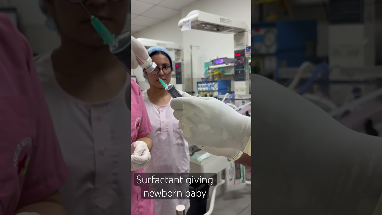 Surfactant giving newborn baby 🏥