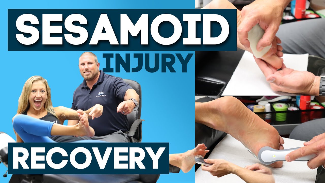 How To Heal From A Sesamoid Injury l Top 3 Tips For FASTER Recovery (MUST KNOW!)