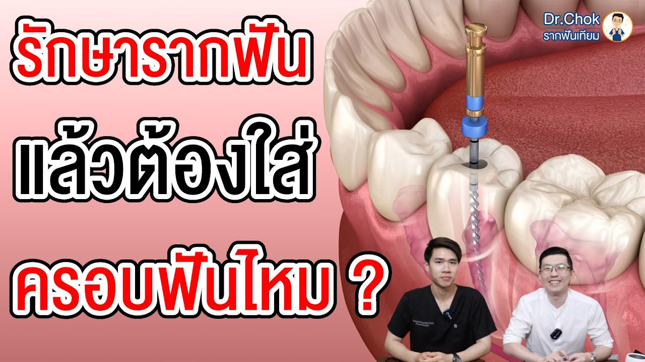 รักษารากฟัน แล้วต้องใส่ครอบฟันไหม ? ไม่ใส่ได้หรือป่าว ? | คลายปัญหาฟันกับหมอโชค