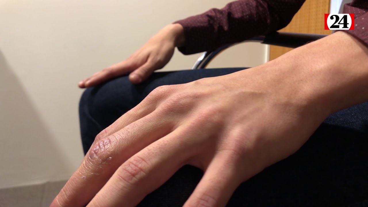 «Ça fait deux ans que je vis avec le VIH»