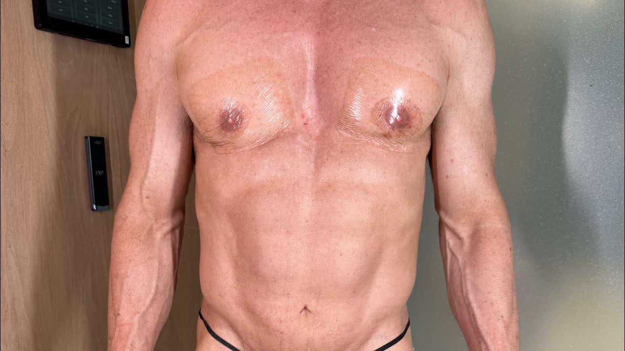 MAXORIS Body Transformation | From Loose to Sculpted & Muscular | Dr. Jason Emer