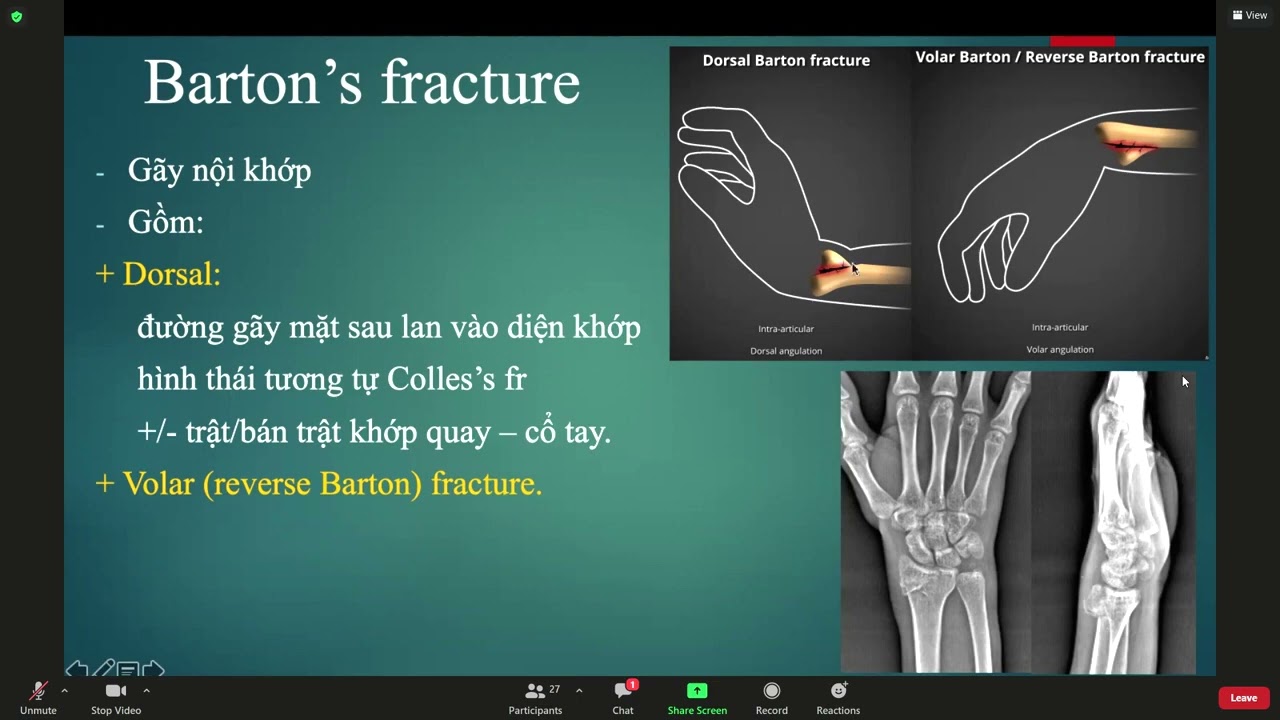 x quang xương cổ tay thầy hùng