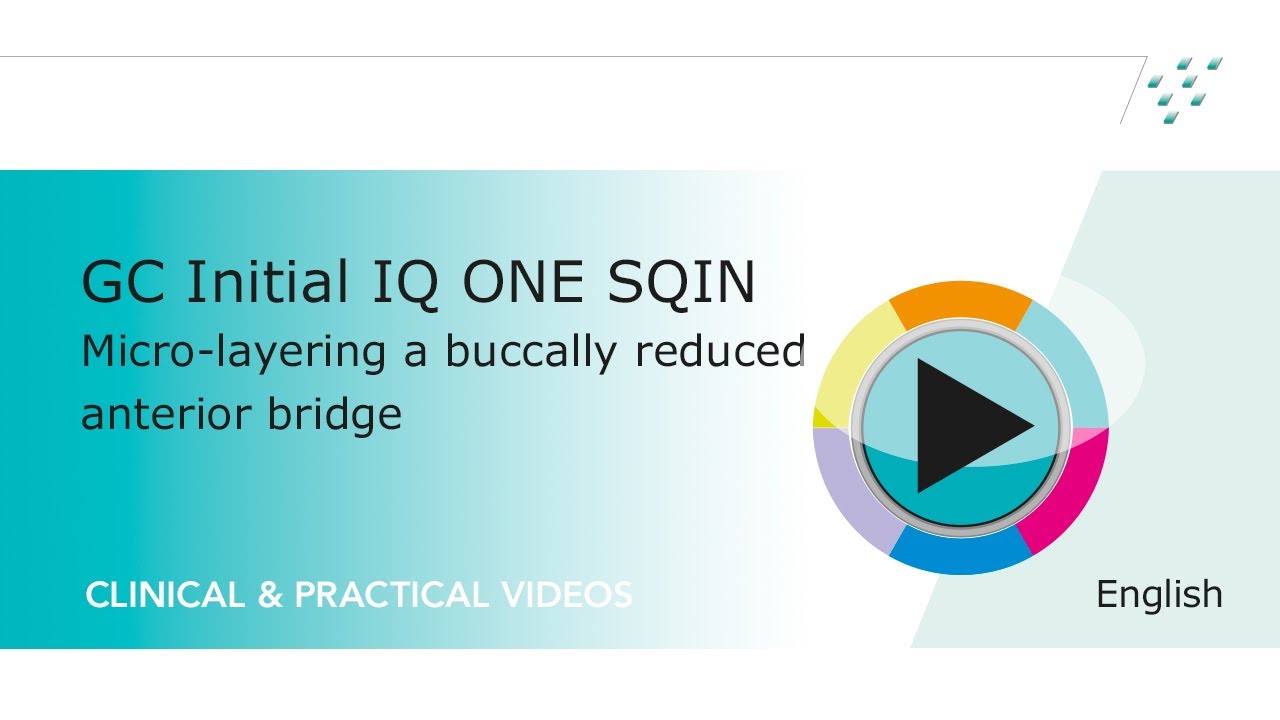 GC Initial IQ ONE SQIN, Micro layering a buccally reduced anterior bridge