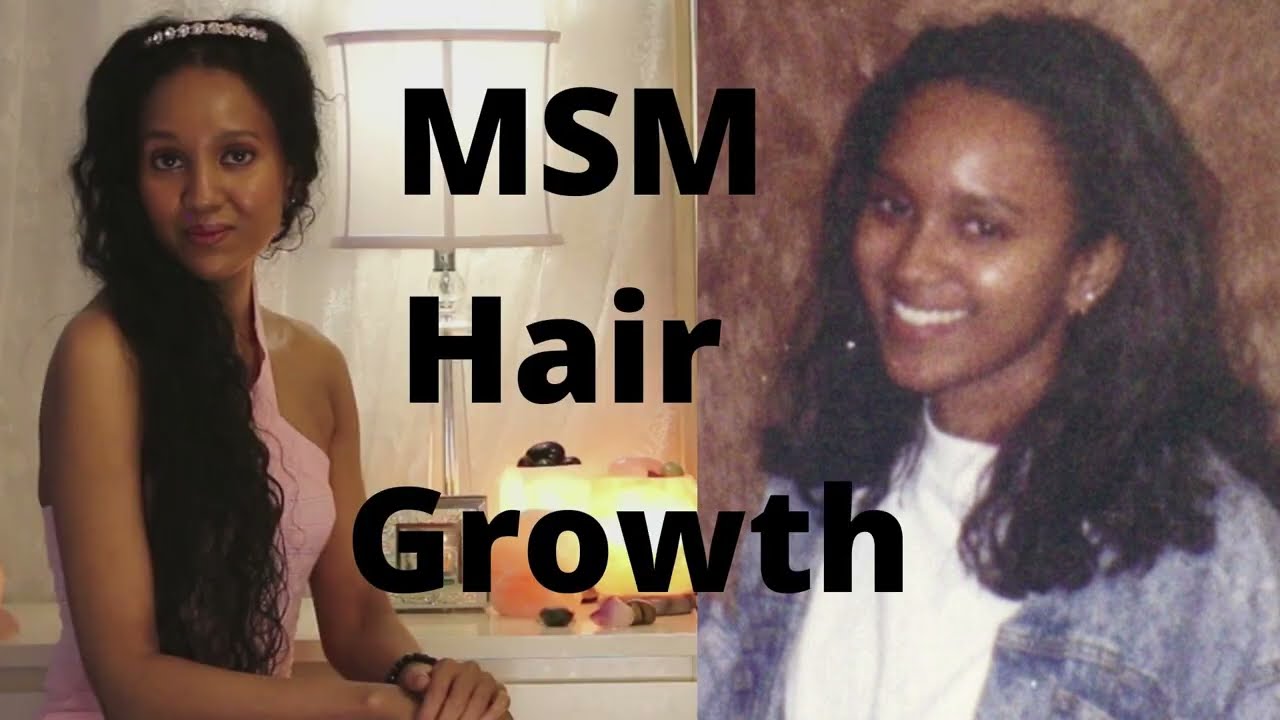 MSM and Hair Growth