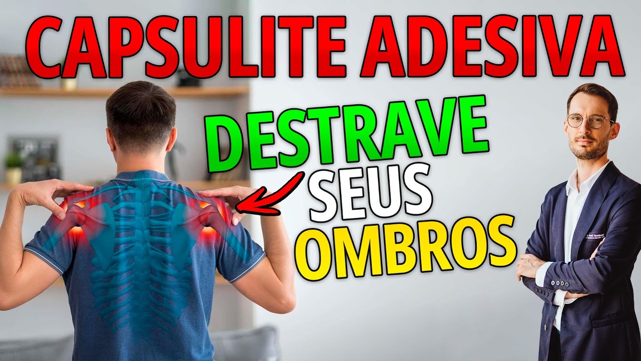 Como destravar o ombro congelado Capsulite adesiva