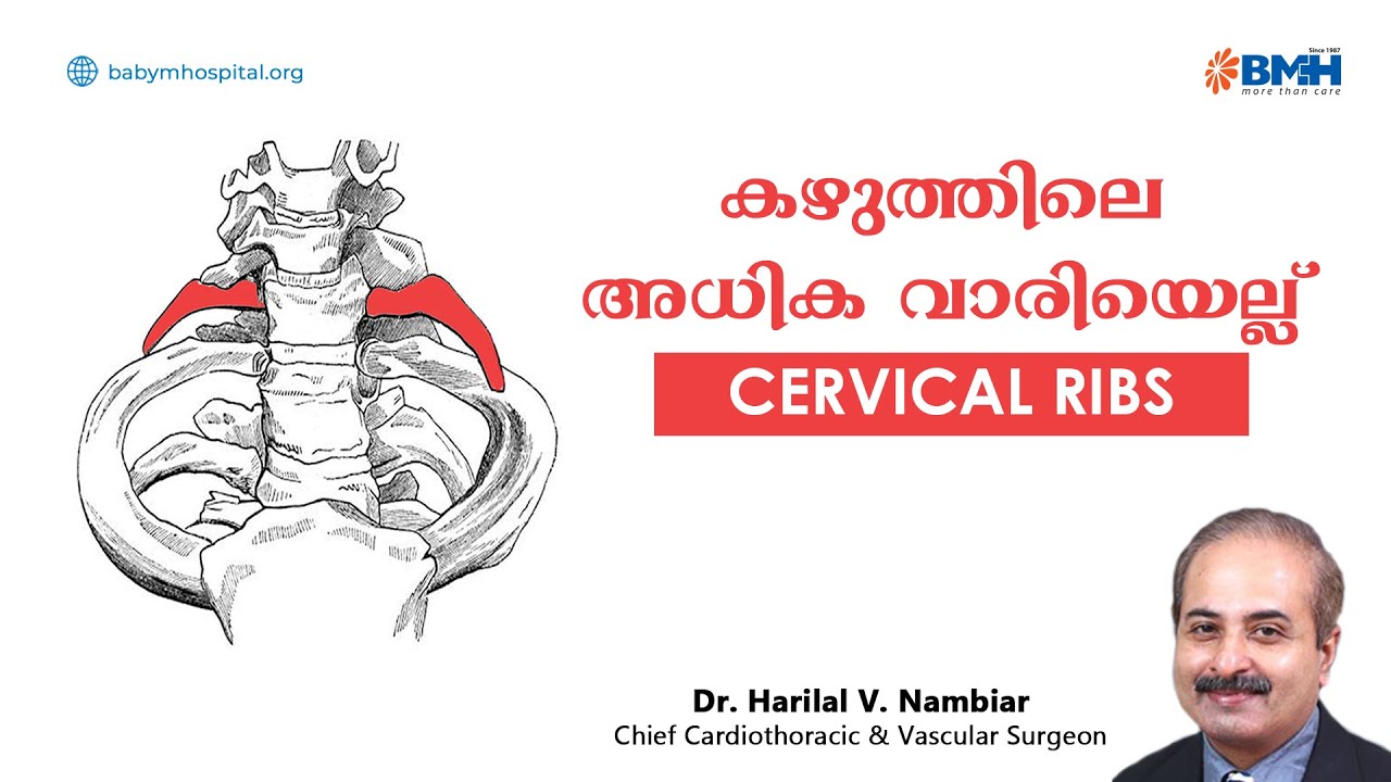 𝐂𝐞𝐫𝐯𝐢𝐜𝐚𝐥 𝐑𝐢𝐛 അഥവാ  കഴുത്തിലെ അധിക വാരിയെല്ല്