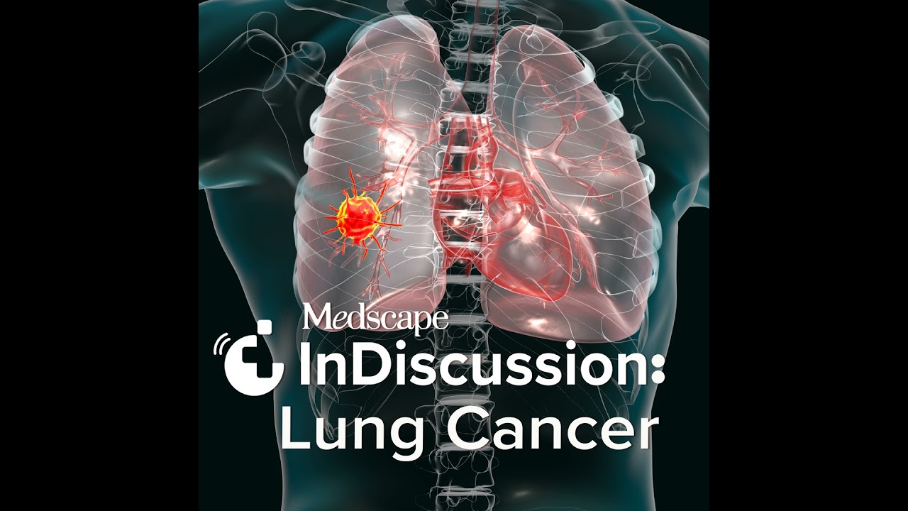 S1 Episode 4: Managing Lung Cancer With Neoadjuvant and Adjuvant Therapy