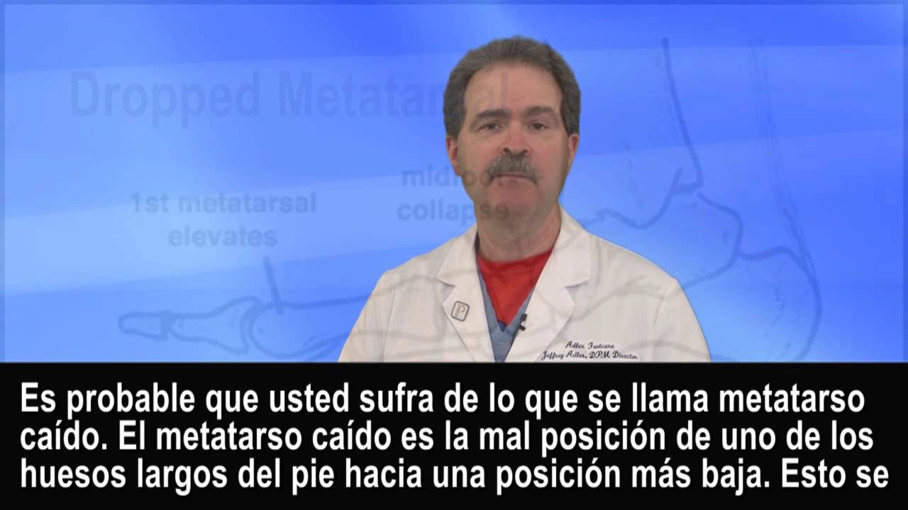 Metatarsos Ca&iacute;dos (Dolor en la Planta del Pie) - Pod&oacute;logo en NYC Manhattan y White Plains, NY