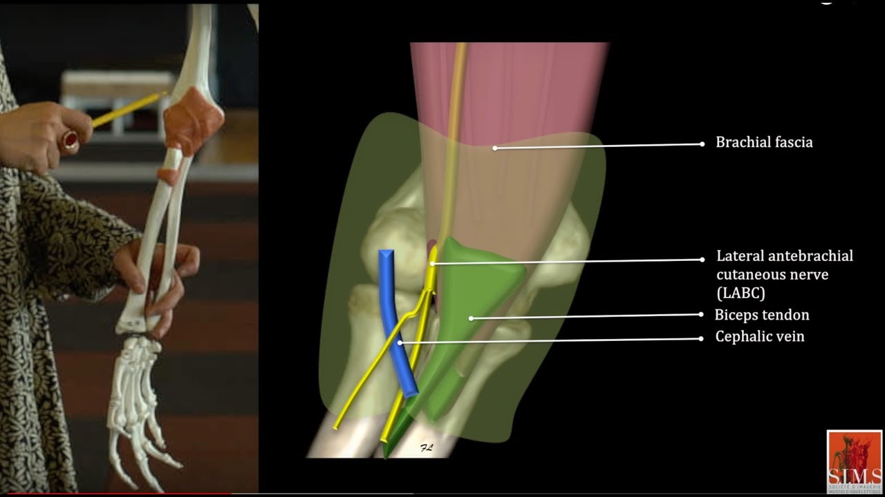 The Musculocutaneous Nerve