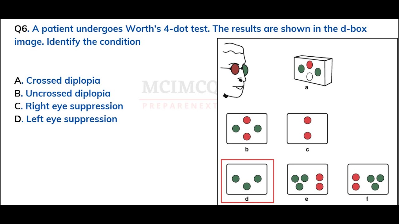 FMGE JAN 2025 EXPECTED QUESTION / PART - 11 / Practice fmge mcq