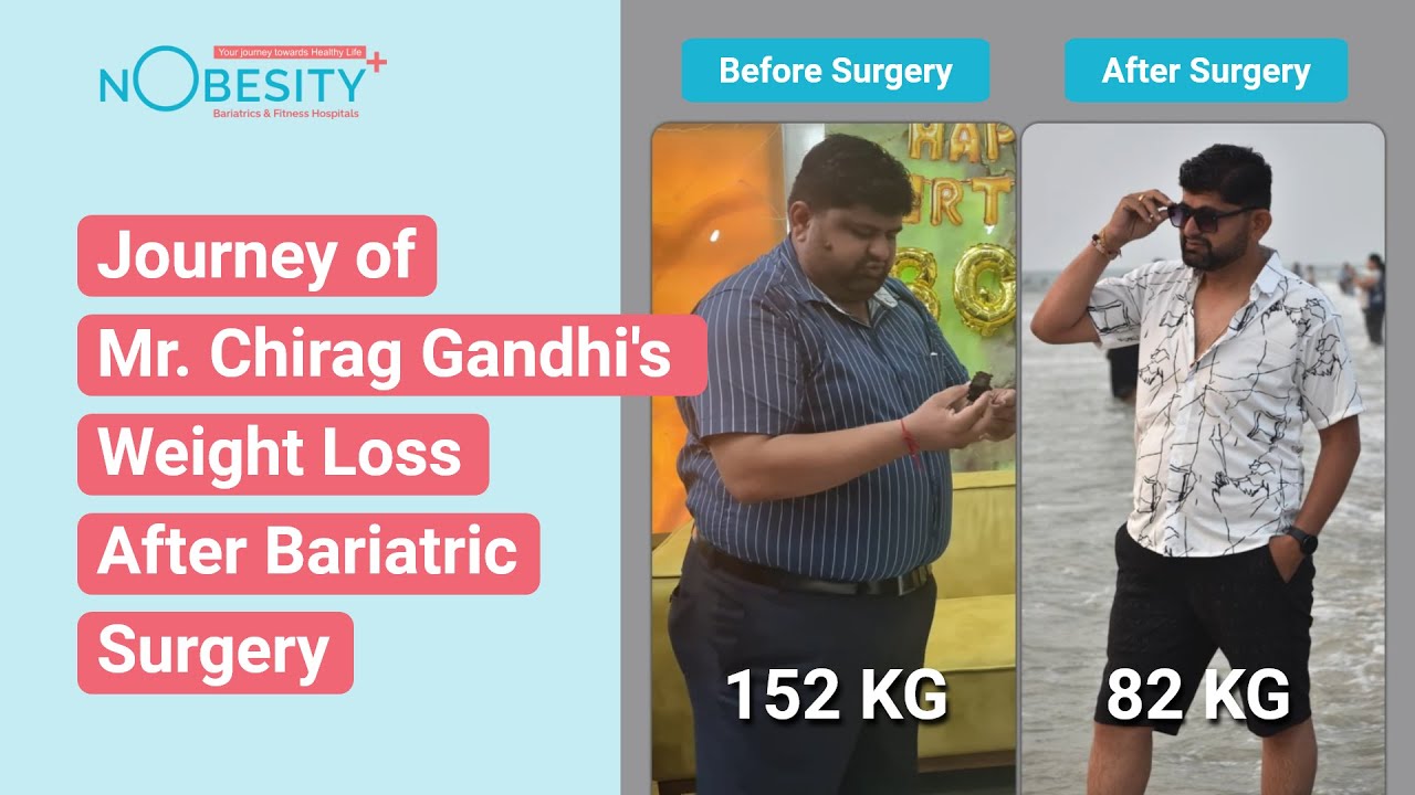 How Chirag Gandhi Lost 70 Kgs in One Year | Life-Changing Journey at NObesity