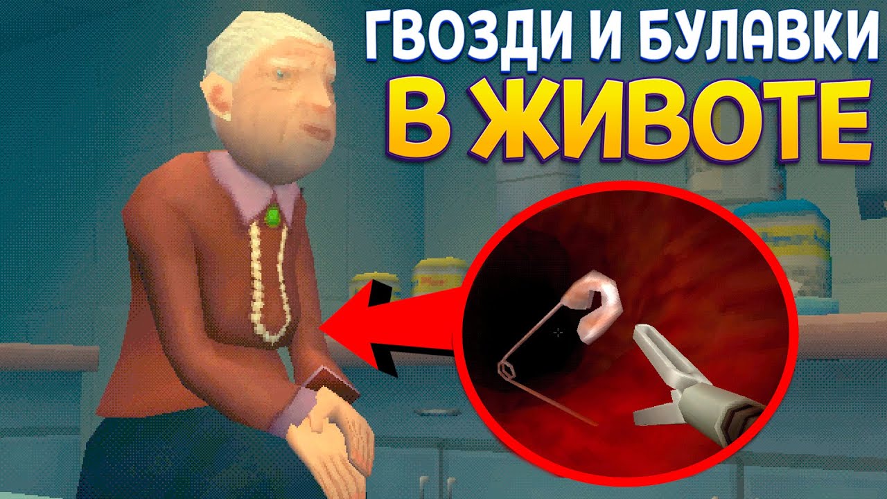 БУЛАВКИ И ГВОЗДИ ВНУТРИ ЖИВОТА