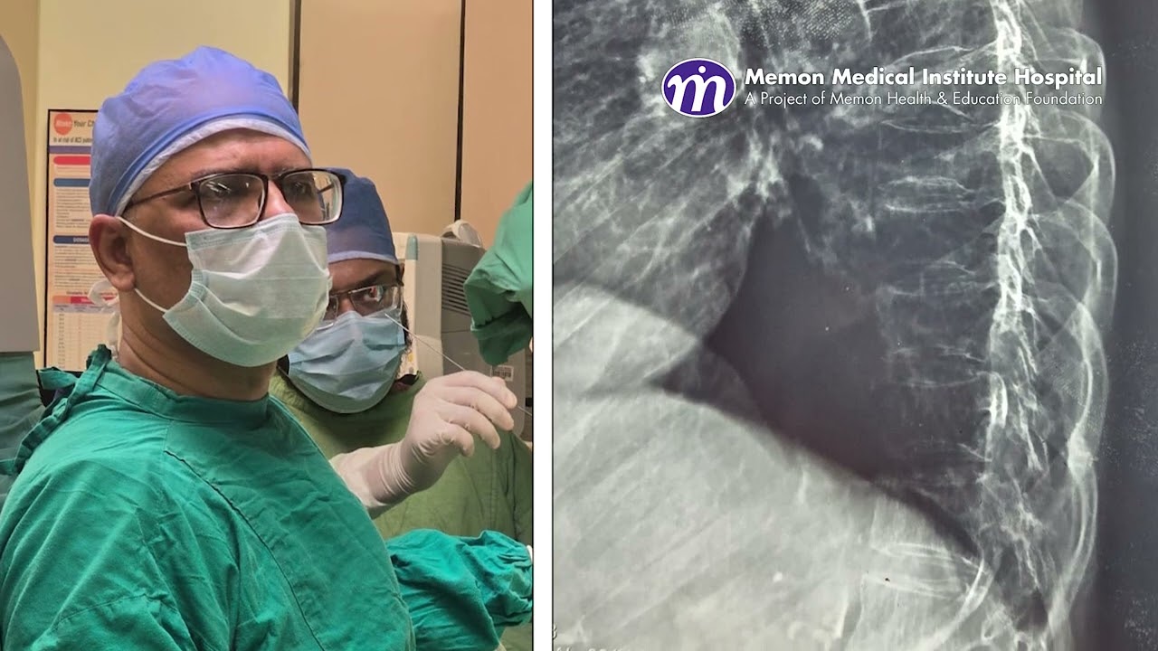 MMI Hospital Introduces Minimal Invasive Spinal Surgery in Karachi!