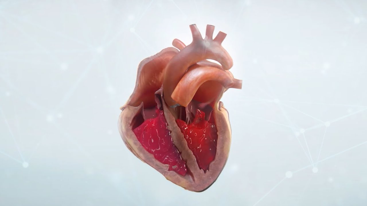 The future of heart failure research and treatment