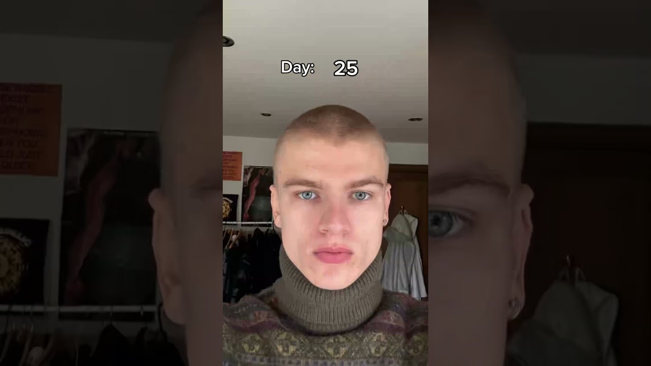 It Won&rsquo;t Grow Back&hellip;