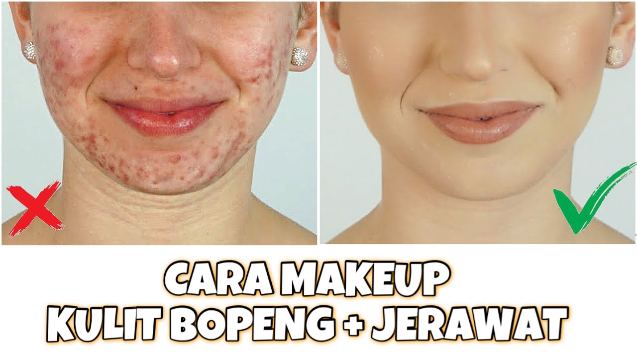 BOPENG LENYAP.!! | MAKEUP UNTUK KULIT BOPENG