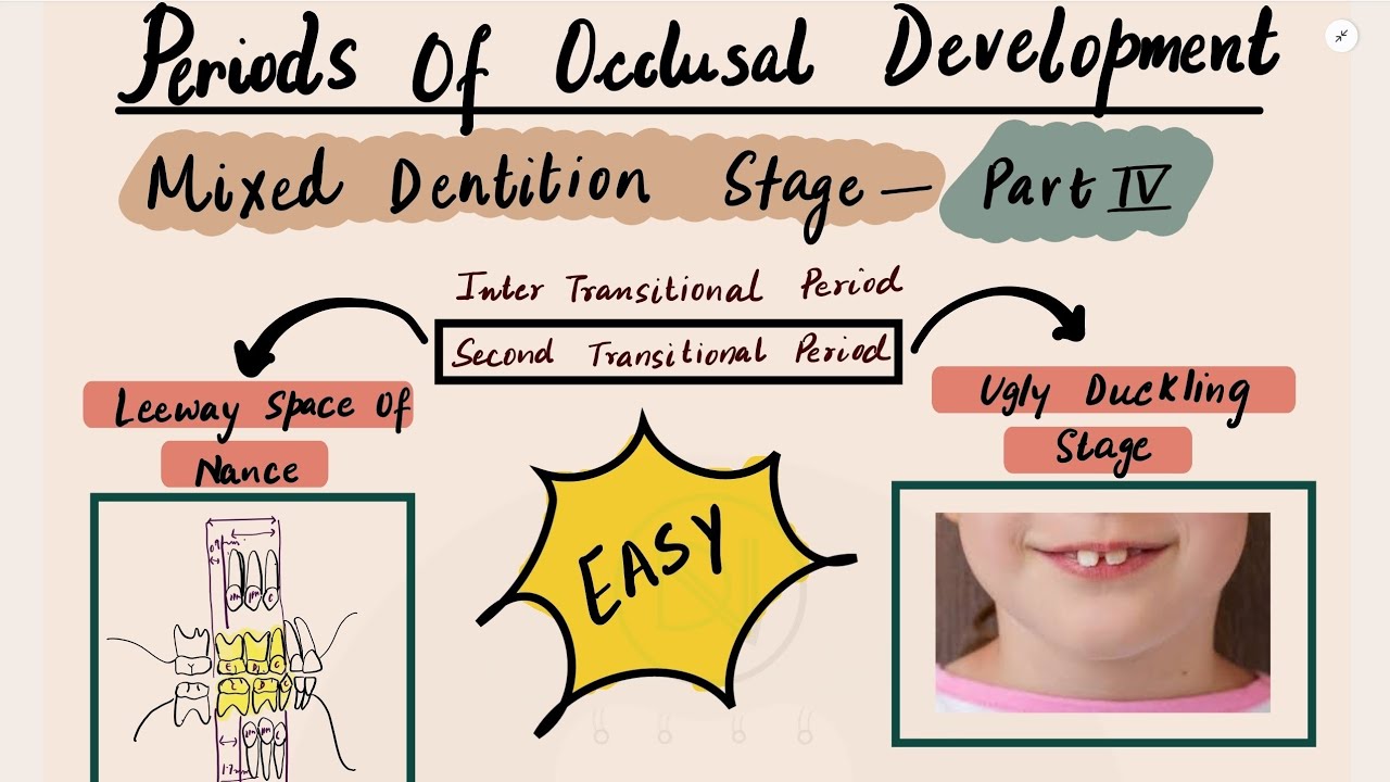 Periods  of occlusal Development | Mixed dentition part4| Leeway space of Nance, Ugly Duckling stage
