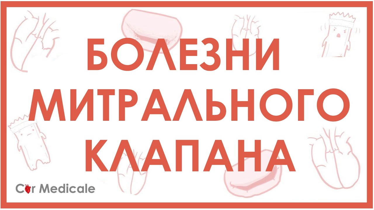 Болезни митрального клапана. Пролапс митрального клапана, стеноз, регургитация.
