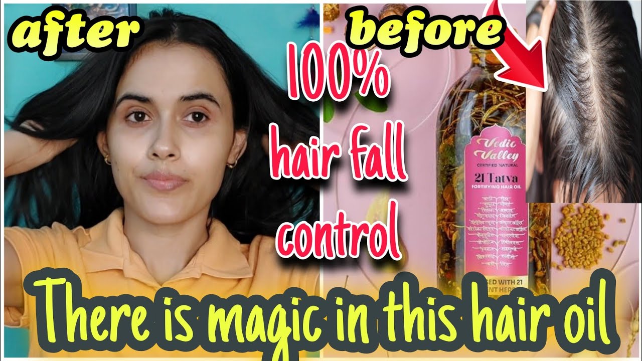 गंजेपन का इलाज | 21 Tatva Hair Oil | Hair Fall Solution | Baldness Solution | Ayurvedic Hair Oil