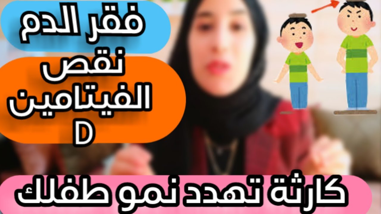علامات نقص الحديد و الفيتامين D عند الأطفال | خطر يوقف نمو طفلك !
