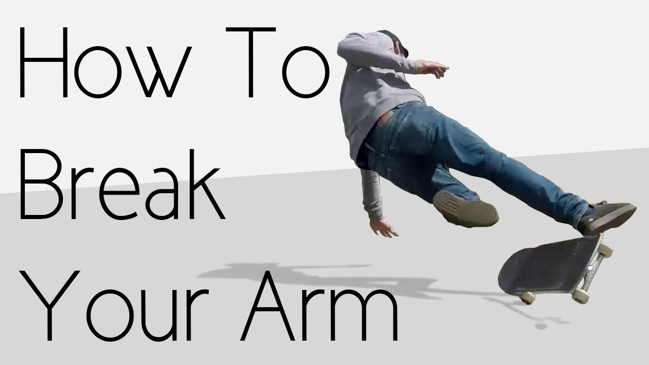 How To Break Your Arm The Easiest Way